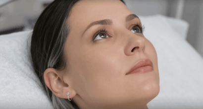 Bioestimuladores de colageno